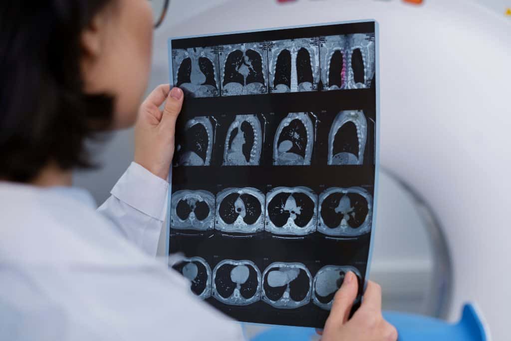 Radiologia: l'AI generativa è il futuro della refertazione - Credits: Freepik