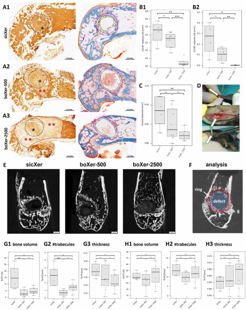 Attività anti-mieloma e stimolante la formazione ossea in vivo di sicXer e boXer nel modello murino di mieloma 5T33 - Credits: Journal of Hematology & Oncology