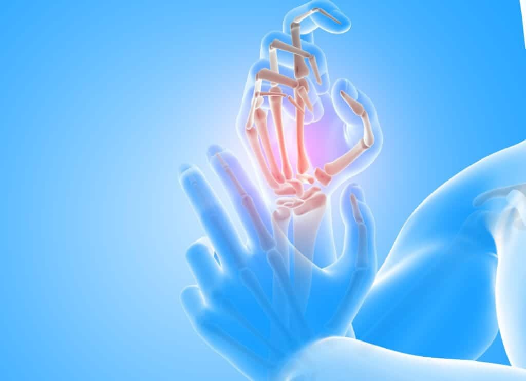 Artrite reumatoide: nuovo studio RESET-RA con neuromodulazione -Credits: Freepik