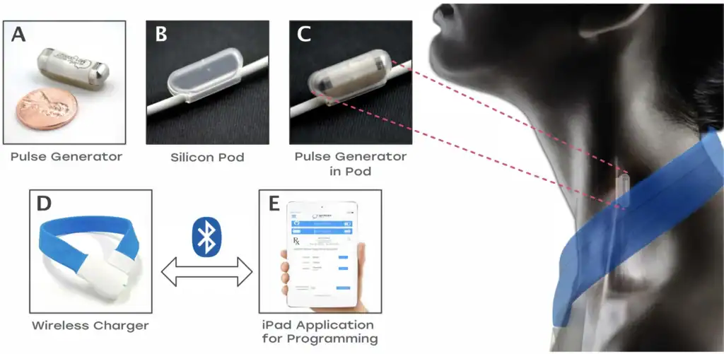 Sistema sviluppano per la modulazione neuroimmunitaria nei pazienti con artrite reumatoide - Credits: Bioelectronic Medicine