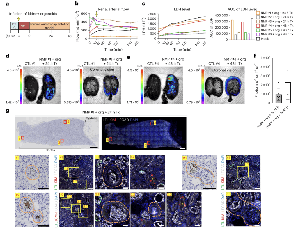Trapianto in vivo di reni suini infusi con organoidi renali umani - Credits: Nature Biomedical Engineering 