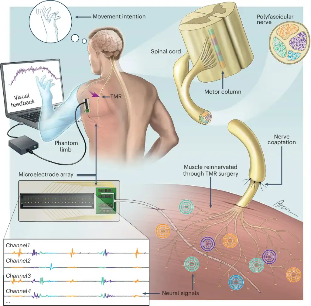 Bio-interfaccia basata sulla TMR di un nervo polifascicolare e utilizzo di un array di microelettrodi per la registrazione e la decodifica - Credits: Nature Biomedical Engineering