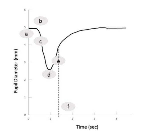La normale reazione della pupilla a uno stimolo luminoso: a) dimensione massima (di base) della pupilla; b) periodo di latenza; c) fase di costrizione; d) dimensione minima; e) fase di dilatazione; f) T75, ovvero il tempo in cui la pupilla recupera il 75% della sua dimensione di base (linea tratteggiata) - Credits: Journal of Clinical Medicine