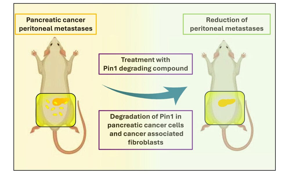 Riassunto grafico dello studio sul tumore del pancreas - Credits: Molecular Therapy Oncology